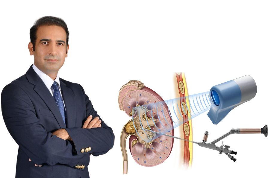 Kidney Stone Laser Treatment in Lahore Pakistan